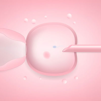 Fertility centre in Ashok nagar