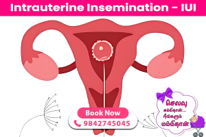 Intrauterine Insemination - IUI
